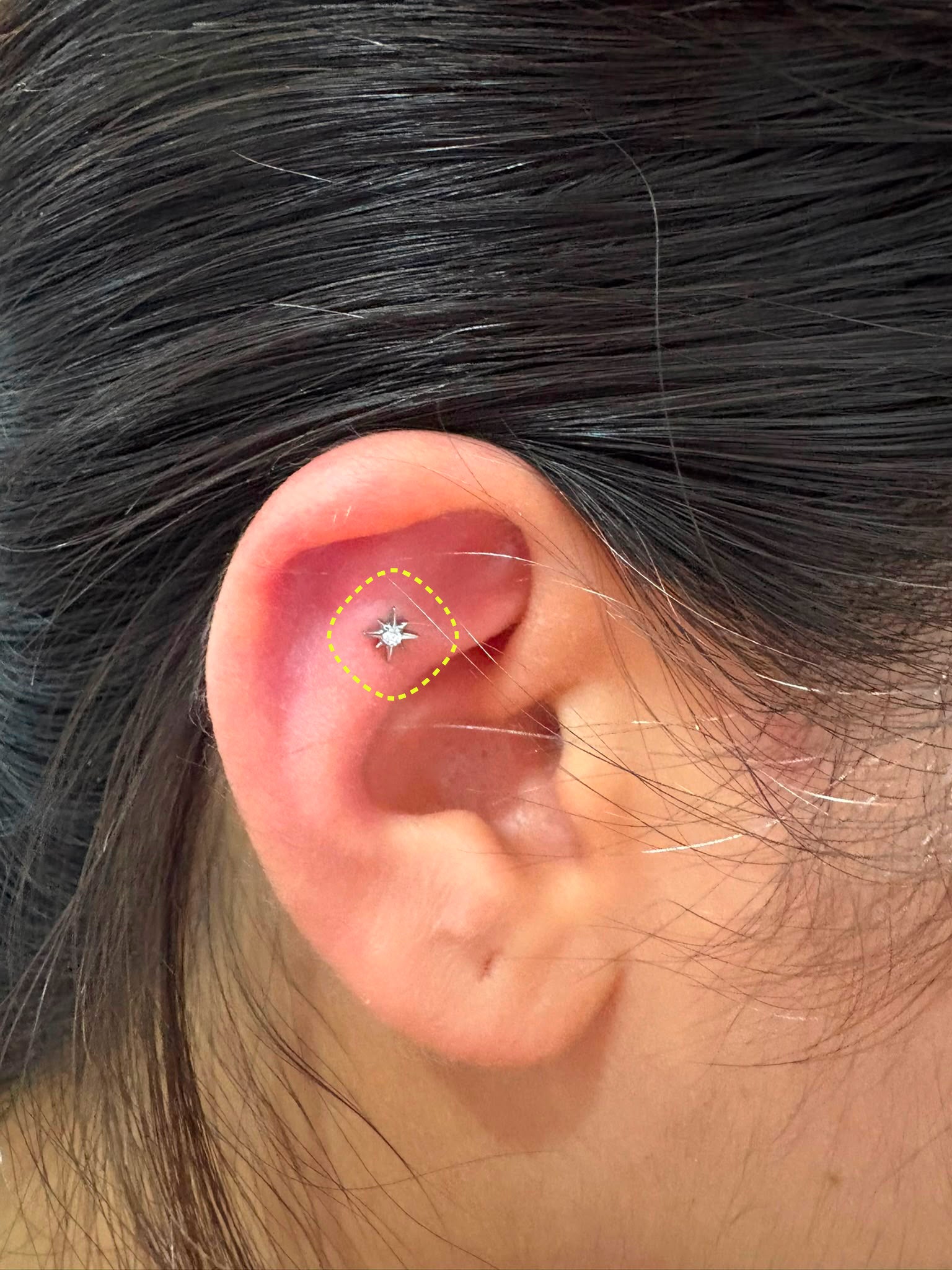 OSCO ear stack