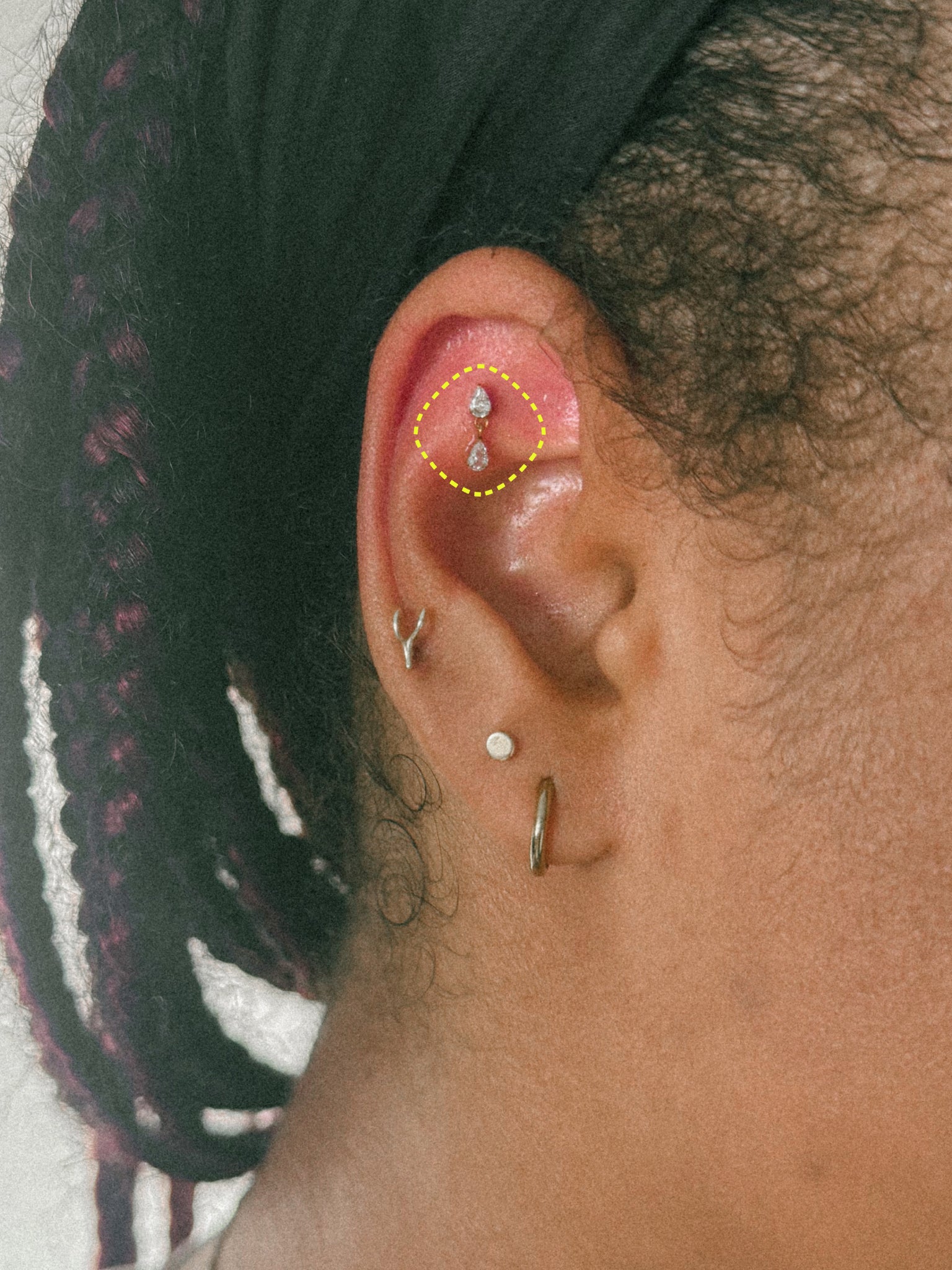OSCO ear stack