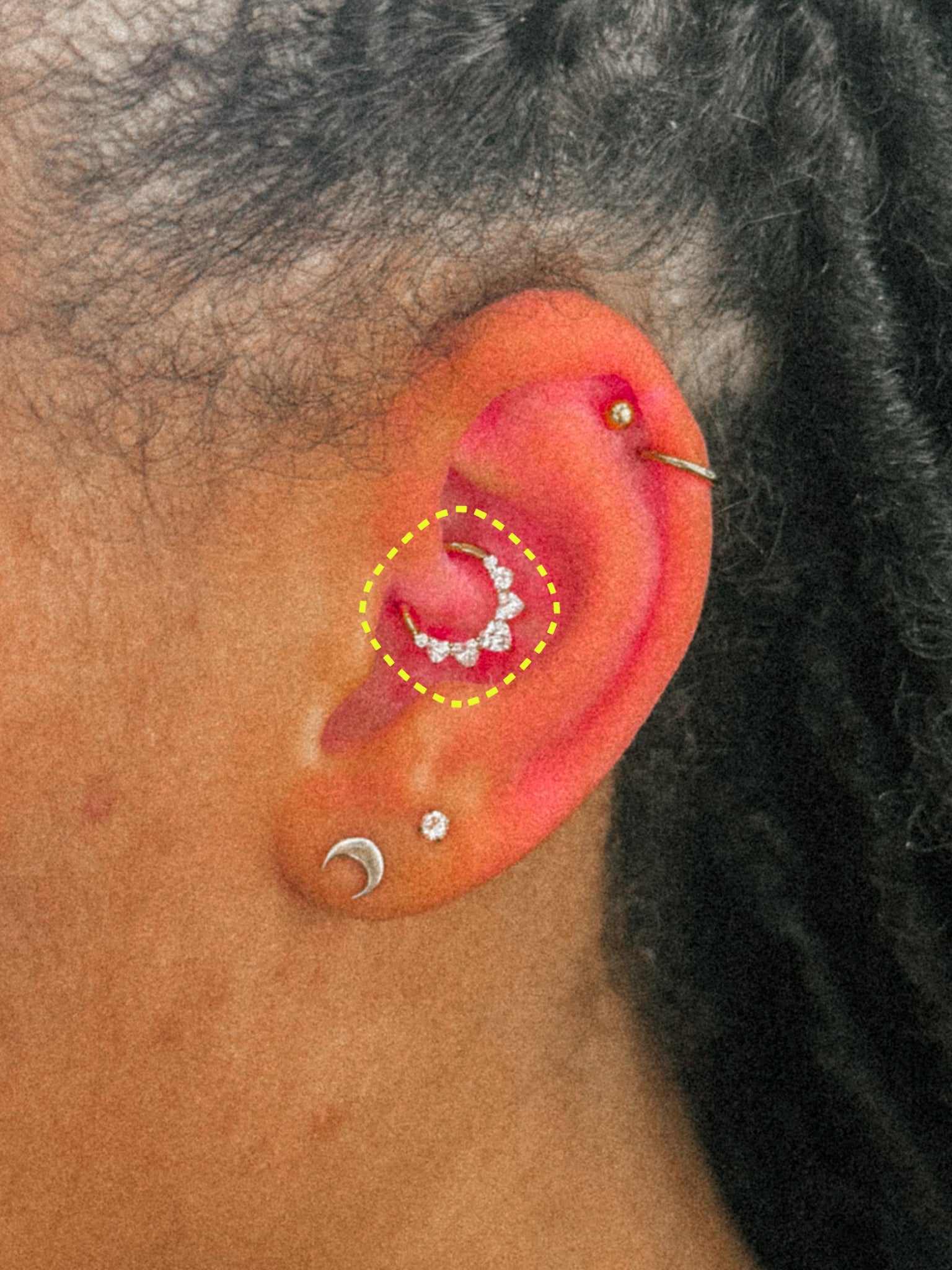 OSCO ear stack
