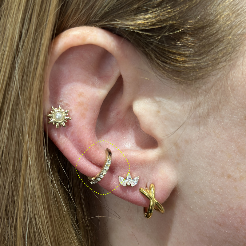 UPPER LOBE