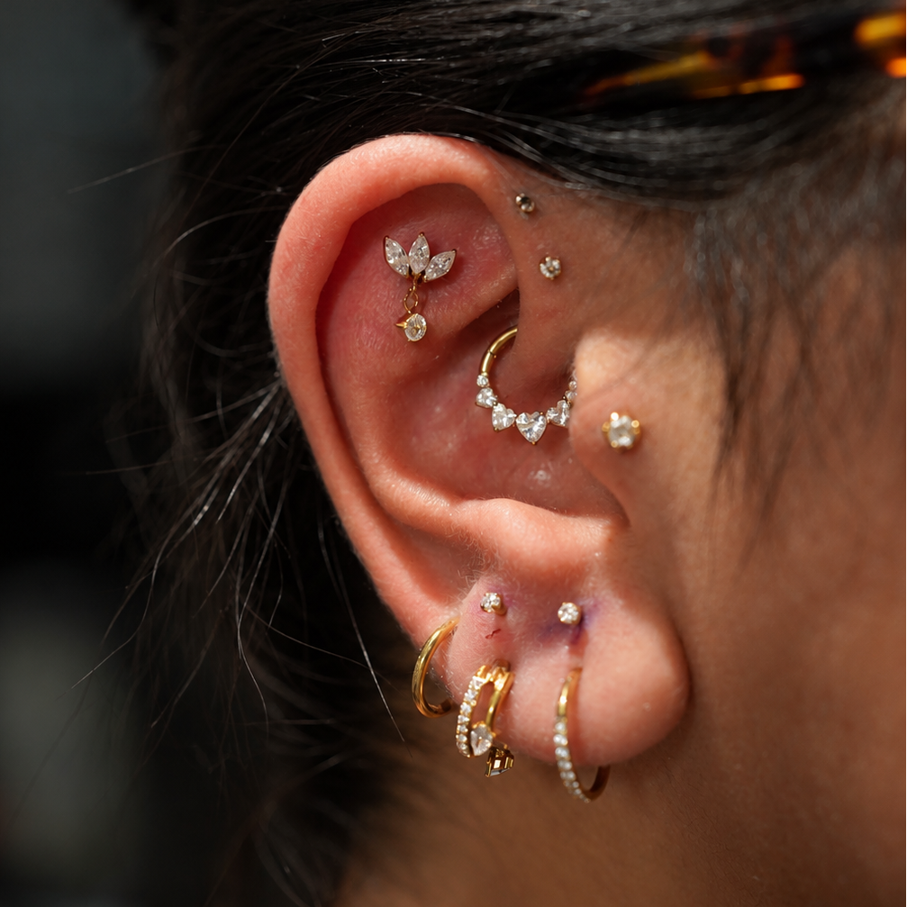 WHAT IS EAR CURATION?